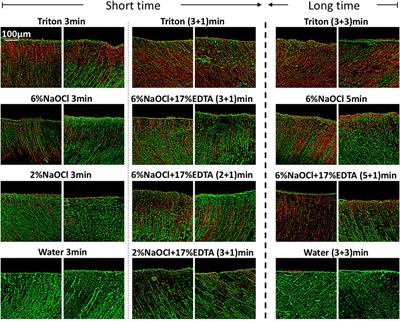 Dual effectiveness of a novel all-in-one endodontic irrigating solution in antibiofilm activity and smear layer removal